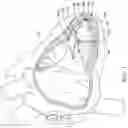 Fig. 02 - Delivery devices and methods for leadless cardiac devices