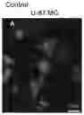 Fig. 01 - Induced cell morphology electroporation