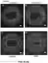 Fig. 08 - Induced cell morphology electroporation