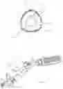Fig. 03 - RF VAGINAL REJUVENATION