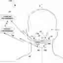 Fig. 01 - Dual prophylactic and abortive electrical stimulation