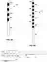Fig. 06 - Dual prophylactic and abortive electrical stimulation