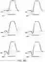 Fig. 09 - Implantable medical devices, systems, and methods for selection of optimal diaphragmatic stimulation parameters to affect pressures within the intrathoracic cavity