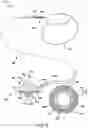 Fig. 19 - Implantable medical devices, systems, and methods for selection of optimal diaphragmatic stimulation parameters to affect pressures within the intrathoracic cavity