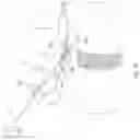 Fig. 22 - Systems and methods for restoring muscle function to the lumbar spine and kits for implanting the same