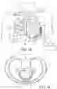 Fig. 02 - Extra-cardiovascular cardiac pacing system for delivering composite pacing pulses