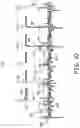 Fig. 10 - Atrial tracking in an intracardiac ventricular pacemaker