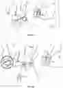 Fig. 05 - External pulse generator device and affixation device for trial nerve stimulation and methods of use