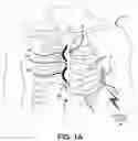 Fig. 02 - Cardiac device system