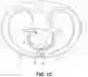 Fig. 04 - Cardiac device system