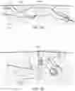 Fig. 03 - Aquatic exercise device for full-body workout and method of use