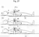 Fig. 16 - Device for Strengthening Inner Abdominal Muscles