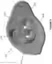 Fig. 04 - Athletic Mouthpieces