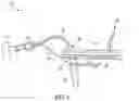 Fig. 05 - Biological fluid separation device