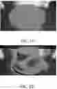 Fig. 02 - Super absorbent resin having improved solidification resistance, and method for preparing same
