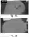 Fig. 04 - Super absorbent resin having improved solidification resistance, and method for preparing same