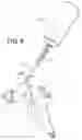 Fig. 08 - Spray gun cleaning system using aerosol can