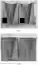 Fig. 05 - Casting method