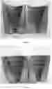 Fig. 06 - Casting method