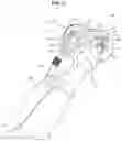 Fig. 07 - Tethering assembly and method for grinders and like tools