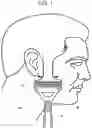 Fig. 02 - Shaving system