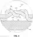 Fig. 05 - Selective attachment of a yarn structure