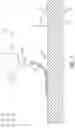 Fig. 08 - Selective attachment of a yarn structure