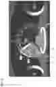 Fig. 10 - Information conveyance method during automatic driving, and in-vehicle information presentation device
