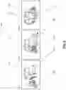 Fig. 03 - Transportation receptacle for vehicles