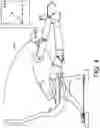 Fig. 05 - Apparatus, system and method for repositioning occupant in a crash event