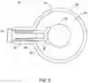 Fig. 06 - Vehicle steering