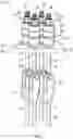 Fig. 03 - Suspension member load sensor