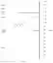 Fig. 03 - PREPARATION METHOD FOR CONJUGATED DIENE COMPOUND