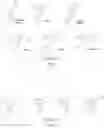 Fig. 02 - Indenyl compounds, pharmaceutical compositions, and medical uses thereof