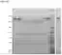 Fig. 70 - Production of heterodimeric proteins