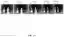 Fig. 16 - GLUTATHIONE-CHOLESTEROL DERIVATIVES AS BRAIN TARGETING AGENTS