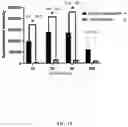 Fig. 17 - GLUTATHIONE-CHOLESTEROL DERIVATIVES AS BRAIN TARGETING AGENTS