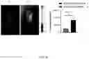 Fig. 18 - GLUTATHIONE-CHOLESTEROL DERIVATIVES AS BRAIN TARGETING AGENTS