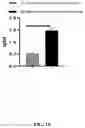 Fig. 20 - GLUTATHIONE-CHOLESTEROL DERIVATIVES AS BRAIN TARGETING AGENTS