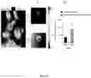 Fig. 21 - GLUTATHIONE-CHOLESTEROL DERIVATIVES AS BRAIN TARGETING AGENTS