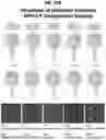 Fig. 43 - Prefusion PIV F immunogens and their use