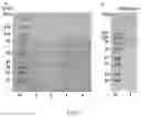 Fig. 06 - Protein of ‘dangshan suli’ having function of promoting growth of pollen tube, encoding gene PBRTTS1 and use thereof