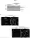 Fig. 17 - MYOMERGER POLYPEPTIDES, NUCLEIC ACID MOLECULES, CELLS, AND RELATED METHODS