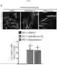 Fig. 19 - MYOMERGER POLYPEPTIDES, NUCLEIC ACID MOLECULES, CELLS, AND RELATED METHODS
