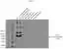 Fig. 53 - PANTIDS FOR TREATMENT OF AUTOIMMUNE DISORDERS