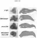 Fig. 13 - Antibody directed against clumping factor a (ClfA)