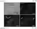 Fig. 33 - Bi-specific fusion proteins