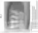 Fig. 33 - Polymer materials for delivery of short-chain fatty acids to the intestine for applications in human health and treatment of disease