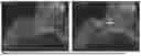 Fig. 04 - Crosslinking of cellulose fibers