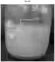 Fig. 04 - Acidizing and proppant transport with emulsified fluid